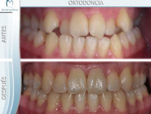Ortodoncia 2