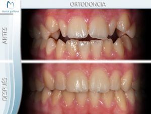 Ortodoncia 3